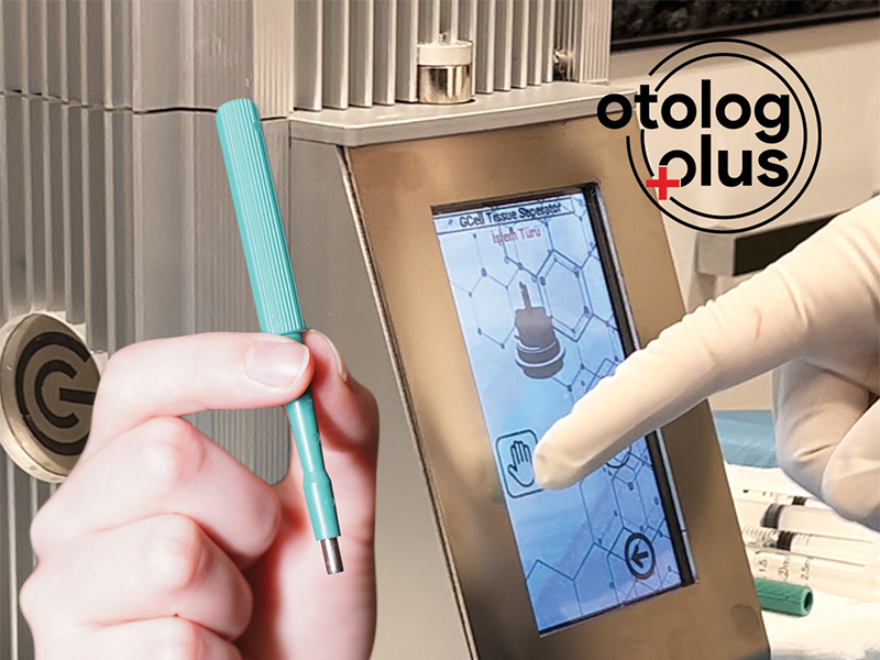 Otolog Plus Kök Hücre Tedavisi